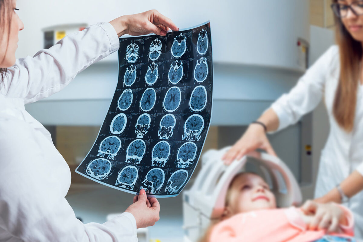 çocuk çağı beyin tümörü