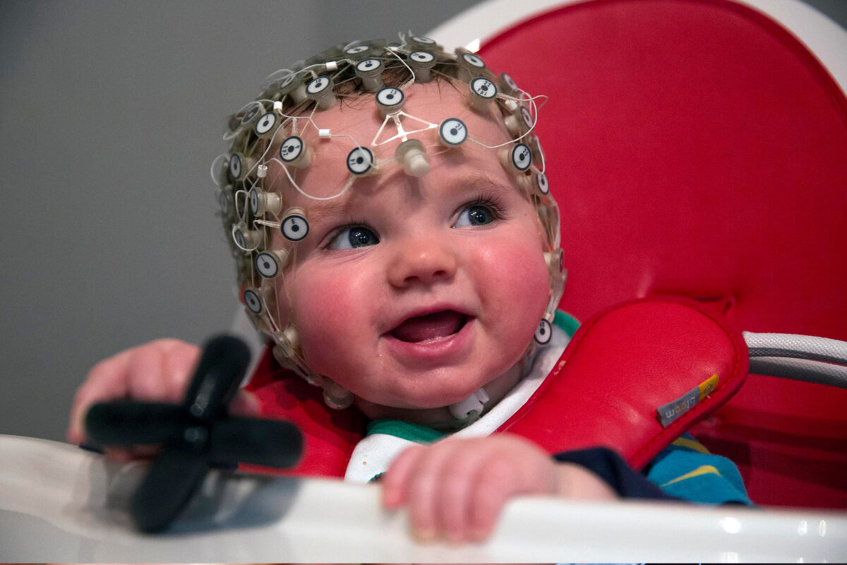 çocuk çağı beyin tümörü 2